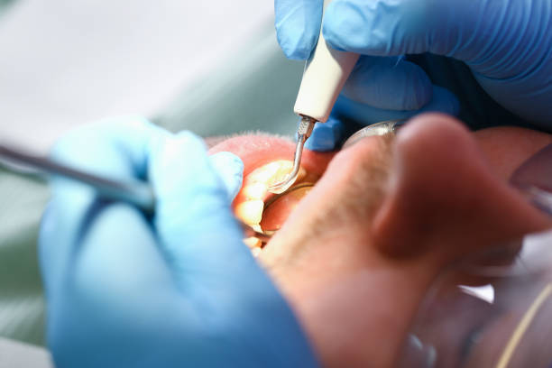 Best Broken or Cracked Tooth Emergency Dentist in Warsaw, IL